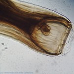 Mikroskopische Fotografie des Mauls oder der "Zähne" eines Strongylus vulgaris, eines der bekanntesten Parasiten des Pferdes