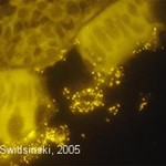 Dickdarmschleimhaut