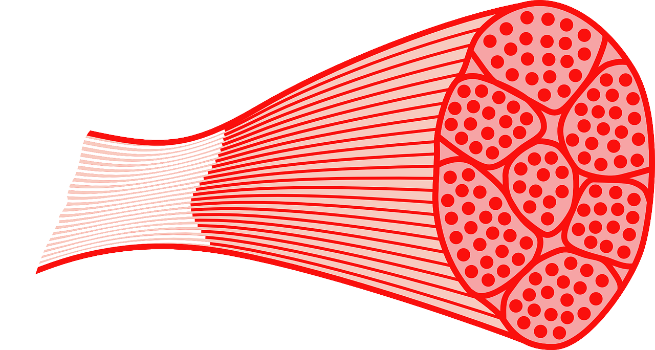 PSSM (Polysaccharid-Speicher-Myopathie)